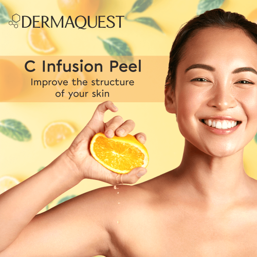 C Infusion Peel