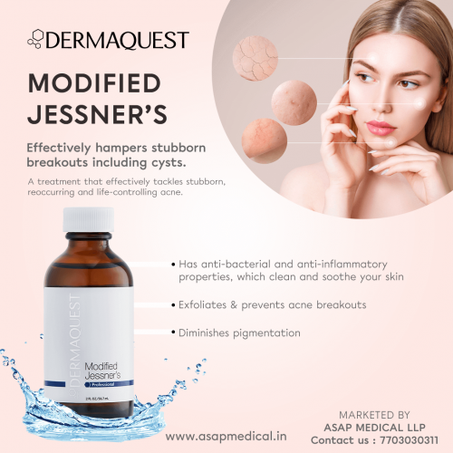 Modified Jessner's Peel