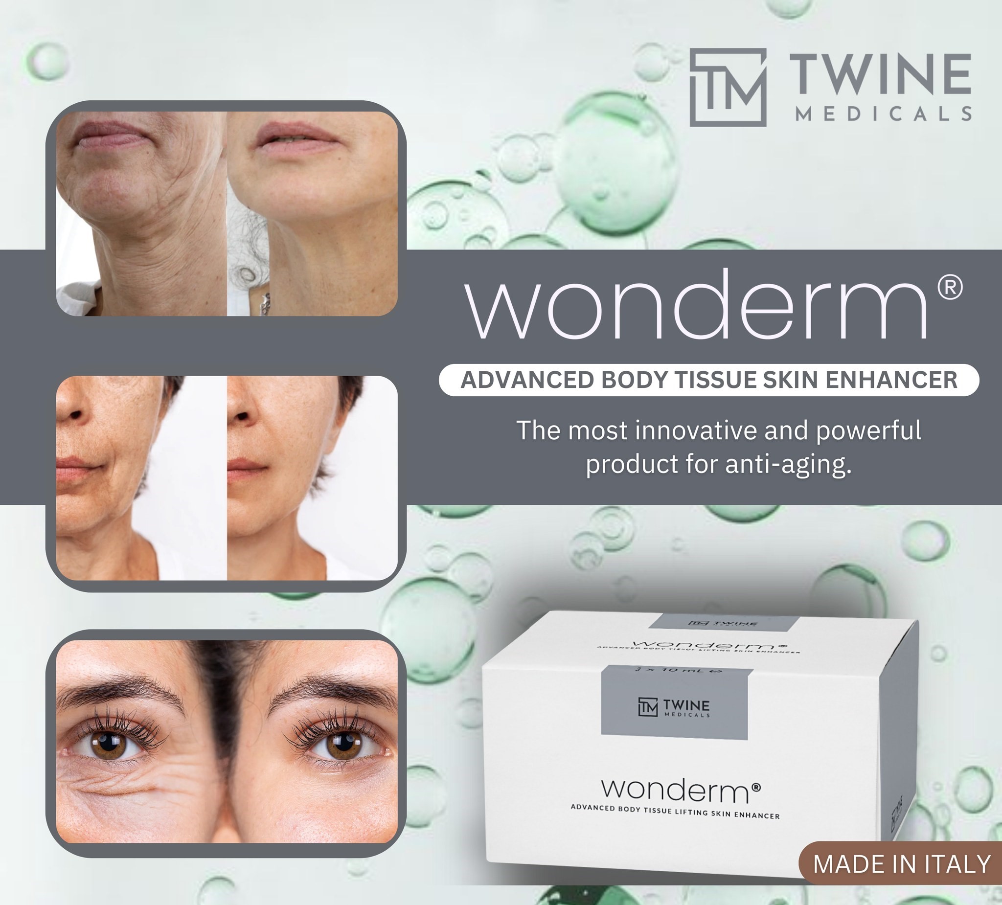 Wonderm
