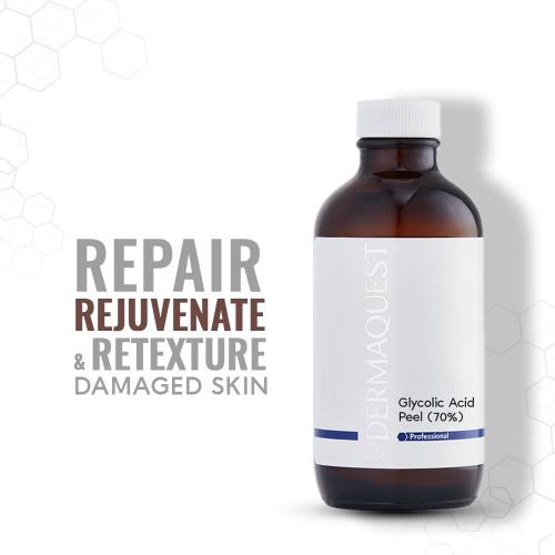 Glycolic Acid Peel 70%