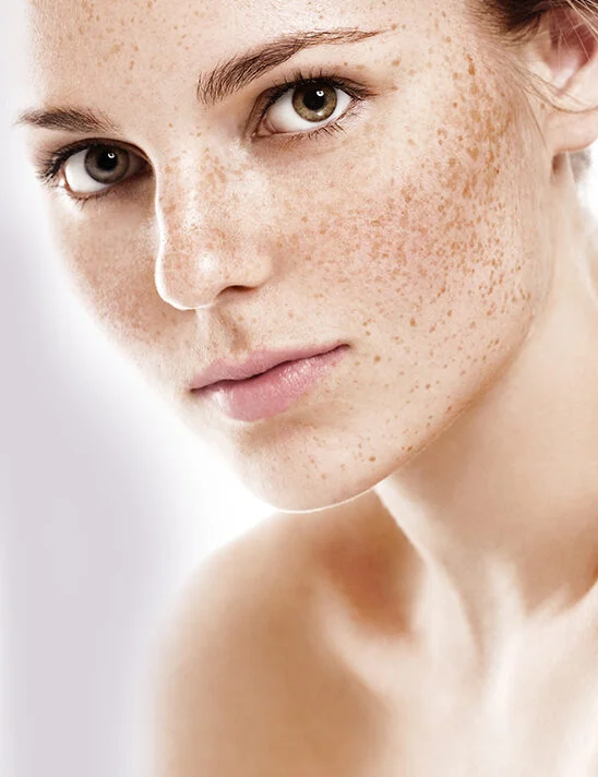 Pigmentation