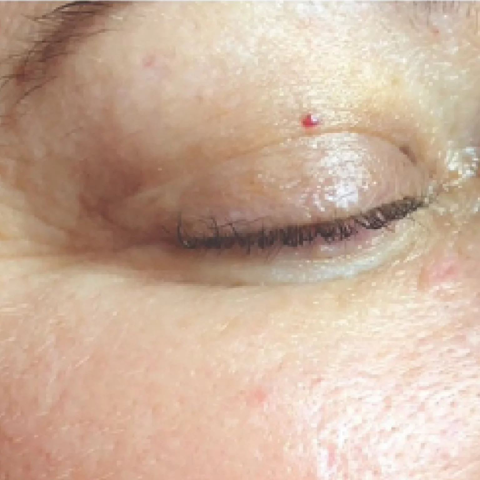 eye