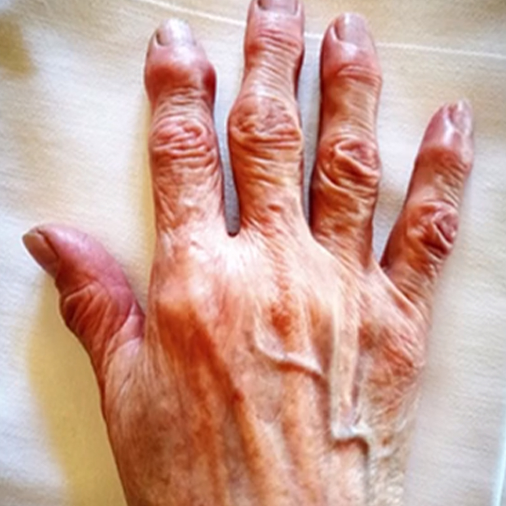 hand