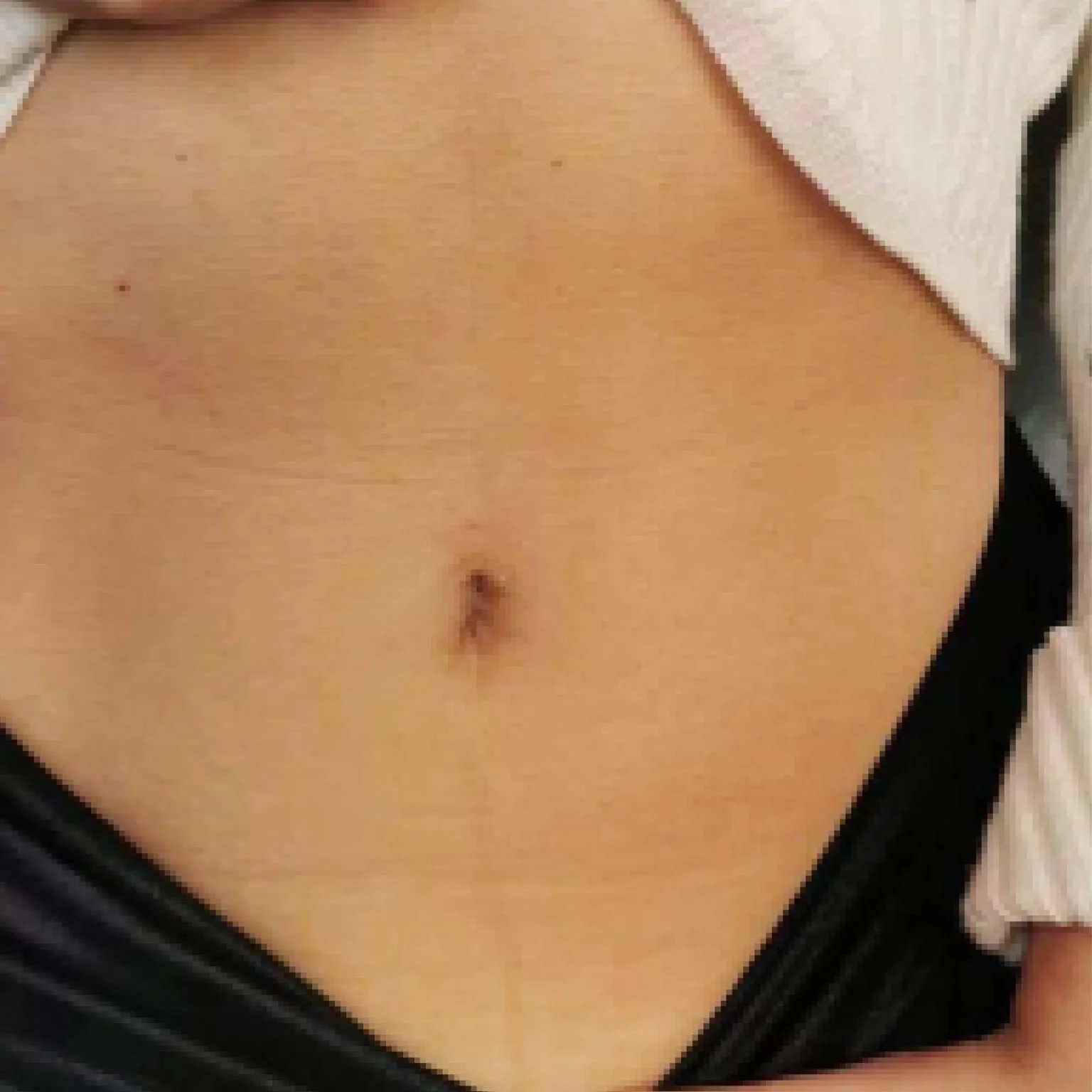 stomach