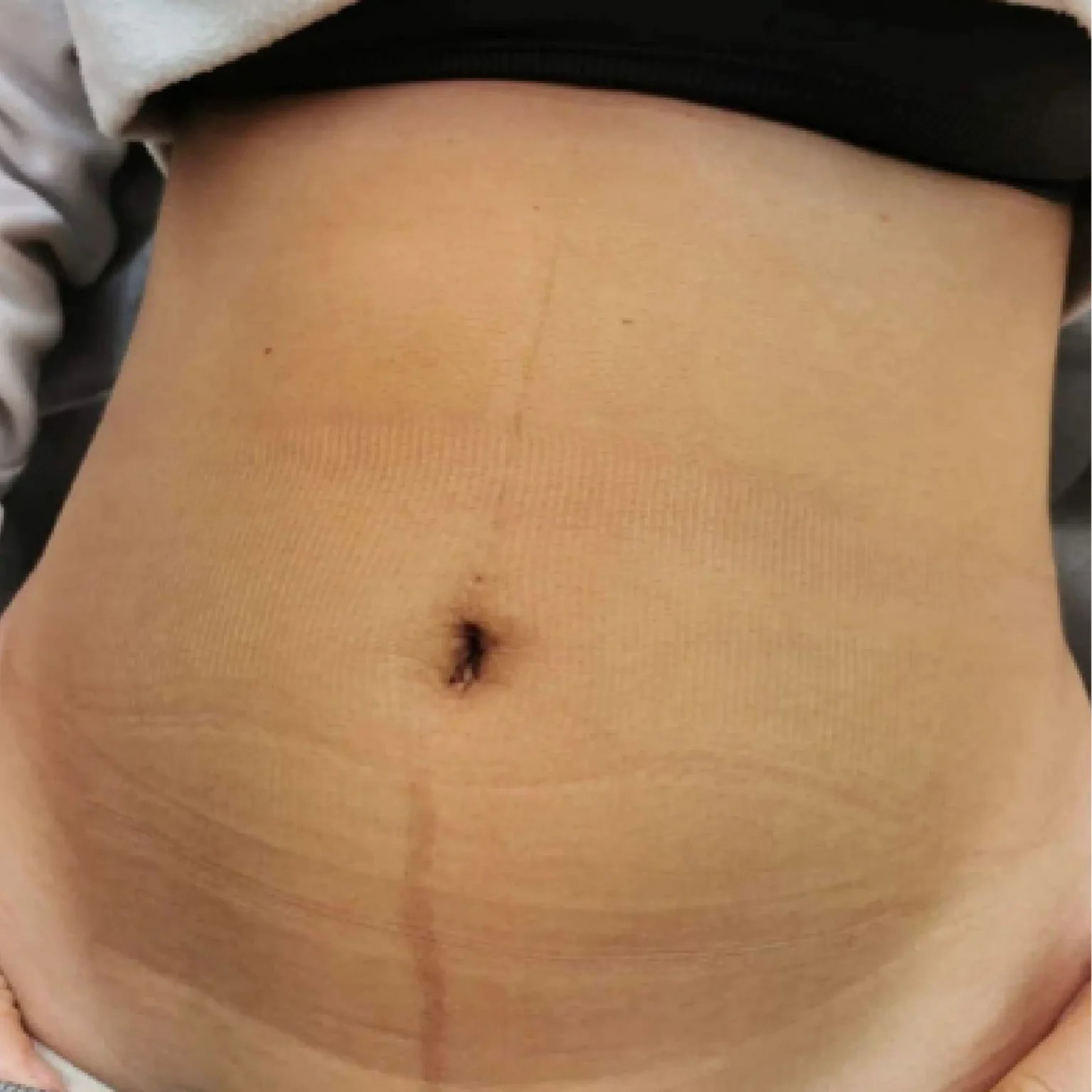 stomach