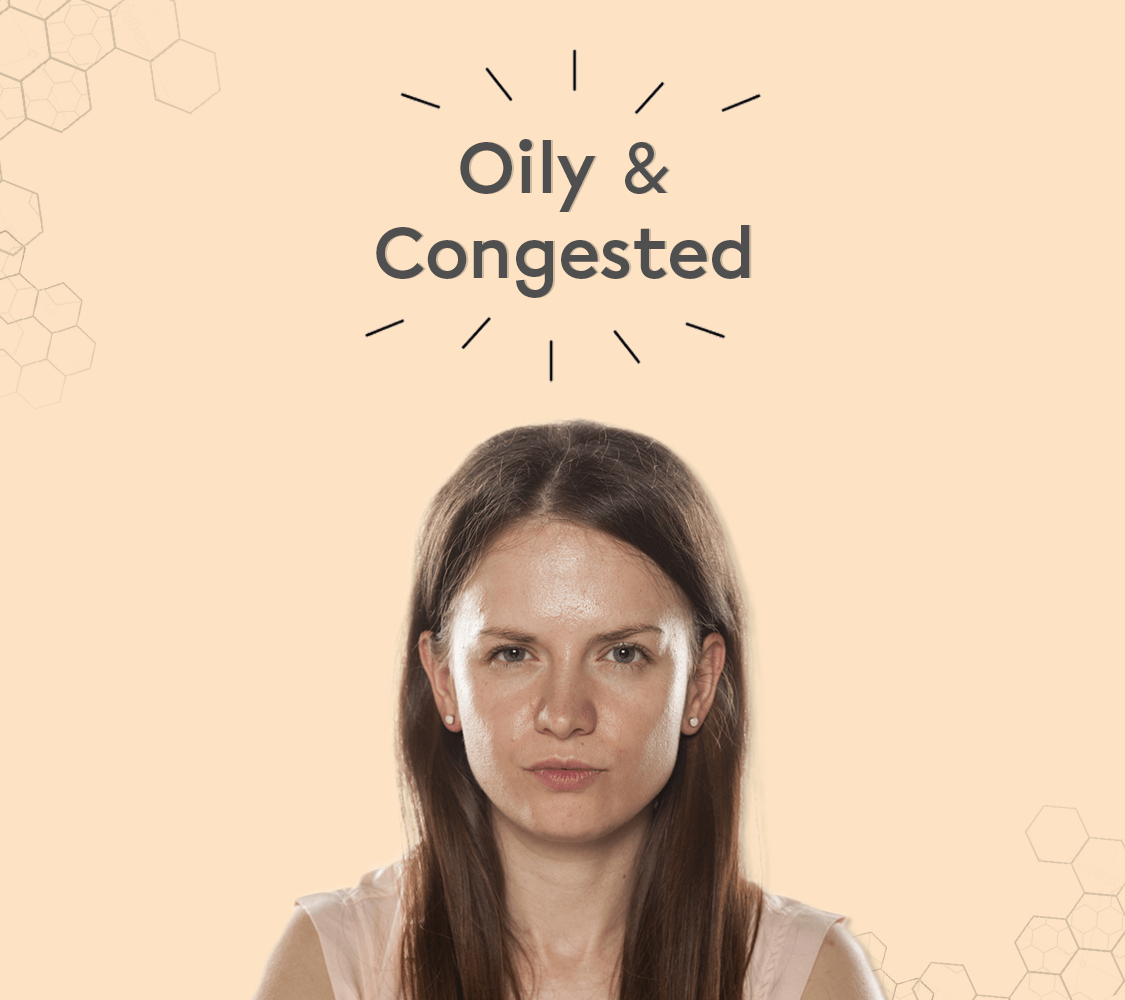 Oily & Congested