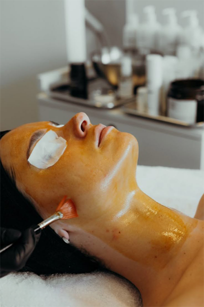 Chemical Peel Recovery: Healing Time And What to Expect