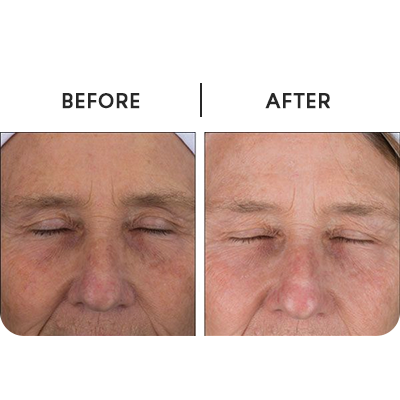 Power Peptide Resurfacer