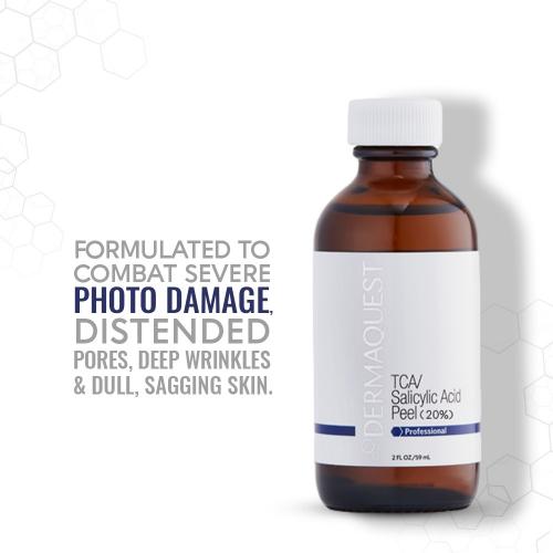 TCA Peel 20%